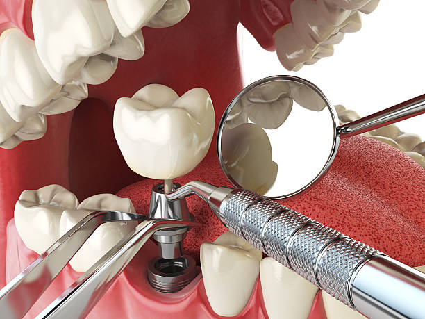 Best Emergency Gum Treatment in Port Vue, PA